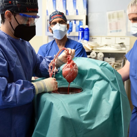Xenotransplantation - Wenn ein Schweineherz im Menschen schlägt