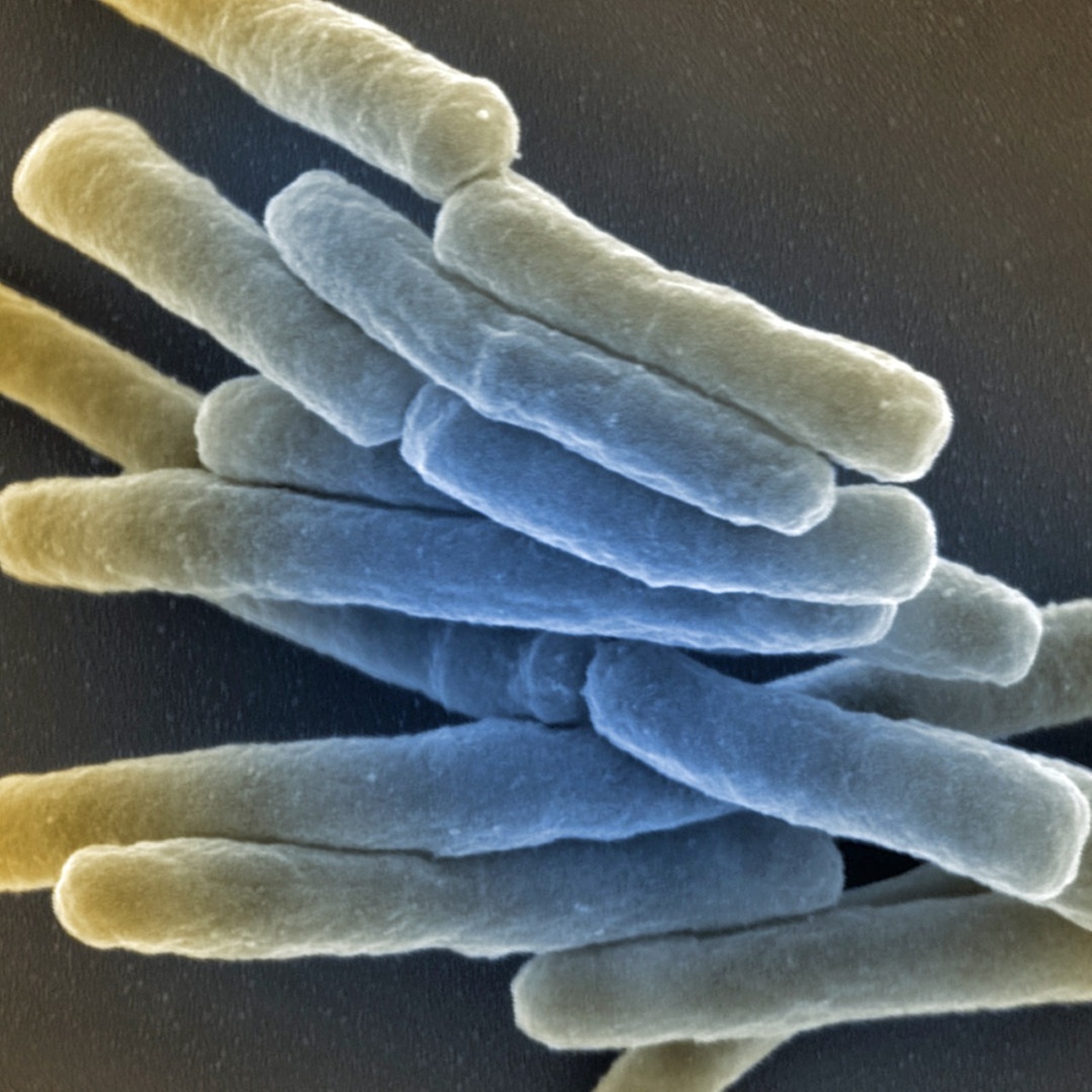 Wissen · Antibiotika gegen Tuberkulose wirksamer machen · Podcast in