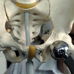 OP oder nicht OP? – Wann ist ein orthopädischer Eingriff sinnvoll?