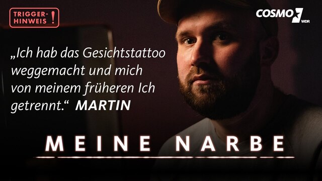 Webvideoreihe "Meine Narbe" - Martin