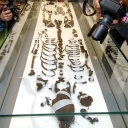Journalisten schauen sich in Hamburg die 2650 Jahre alten sterblichen Überreste eines Mädchens, das im Uchter Moor in Niedersachsen gefunden wurde. Hamburger Rechtsmediziner wollen der niedersächsischen Moorleiche &#034;Moora&#034; ein Gesicht geben.