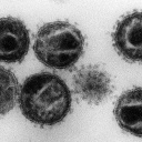 Eine undatierte elektronenmikroskopische Aufnahme zeigt mehrere Humane Immunschwäche-Viren (HIV)