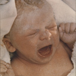 Am 25. Juli 1978 kam Louise Joy Brown bei Manchester zur Welt - das erste Baby aus einer künstlichen Befruchtung