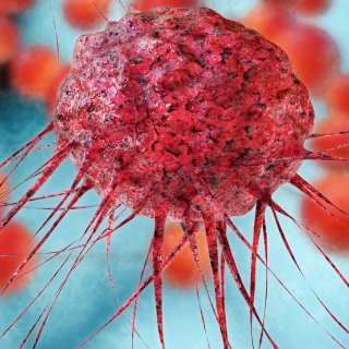 Grafik einer Krebszelle