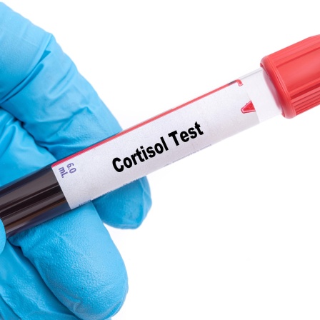 Symbolbild: Cortisol Test