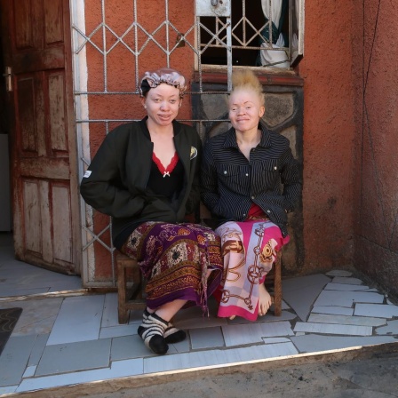 Zwei junge afrikanische Frauen mit für Albinismus charakteristisch heller Hautfarbe sitzen vor einem Haus und lachen in die Kamera.