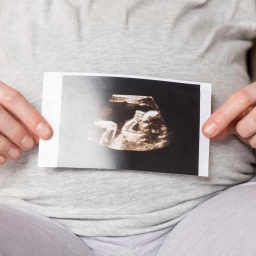 Nahaufnahme einer schwangeren Frau mit Ultraschallbild.
