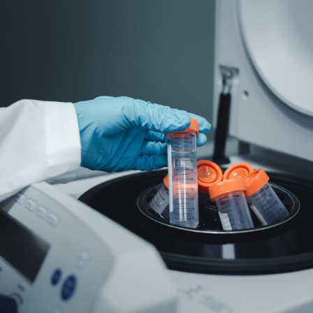 DNA-Test