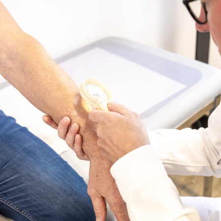 Ein Hausarzt untersucht in seiner Praxis die Haut am Arm eines Patienten mit Hilfe einer Lupe