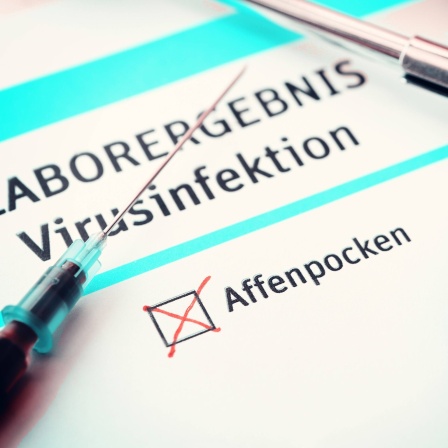 Positives Testergebnis für Affenpocken-Infektion